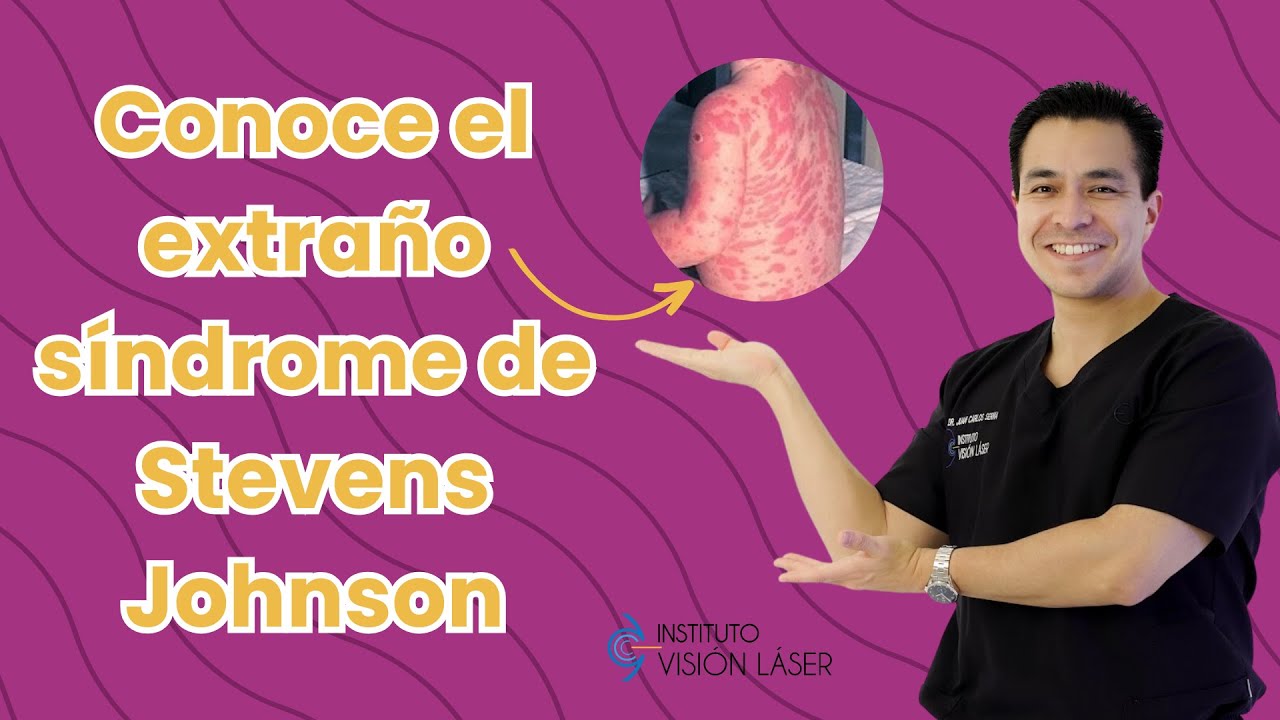 S&iacute;ndrome de Stevens Johnson &iquest;conoces esta rara enfermedad?
