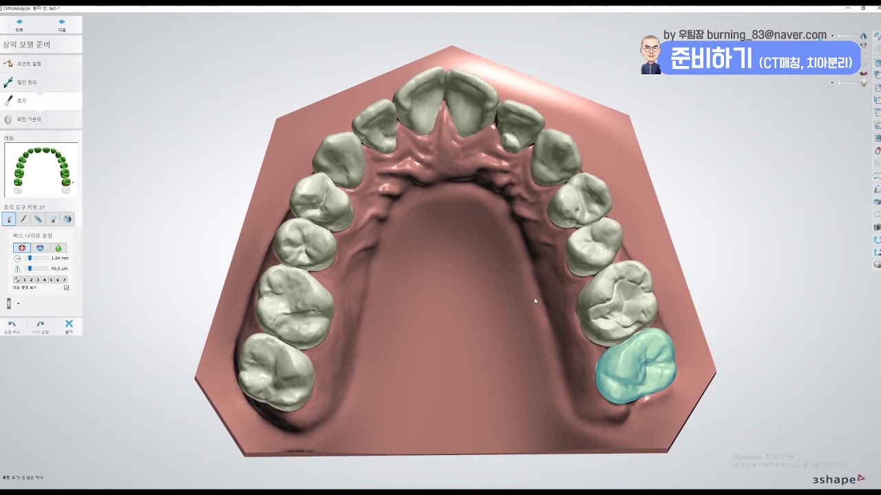 3shape ortho analyzer  준비하기