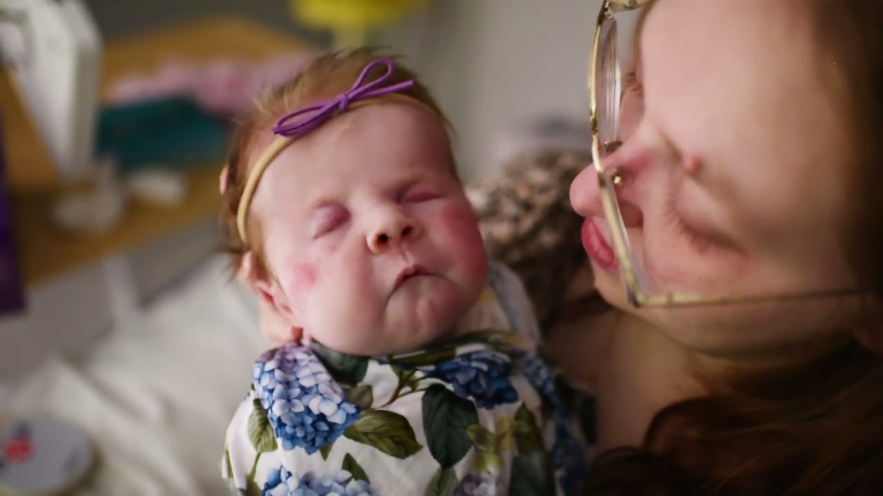 Abigail - Trisomy 9 Awareness