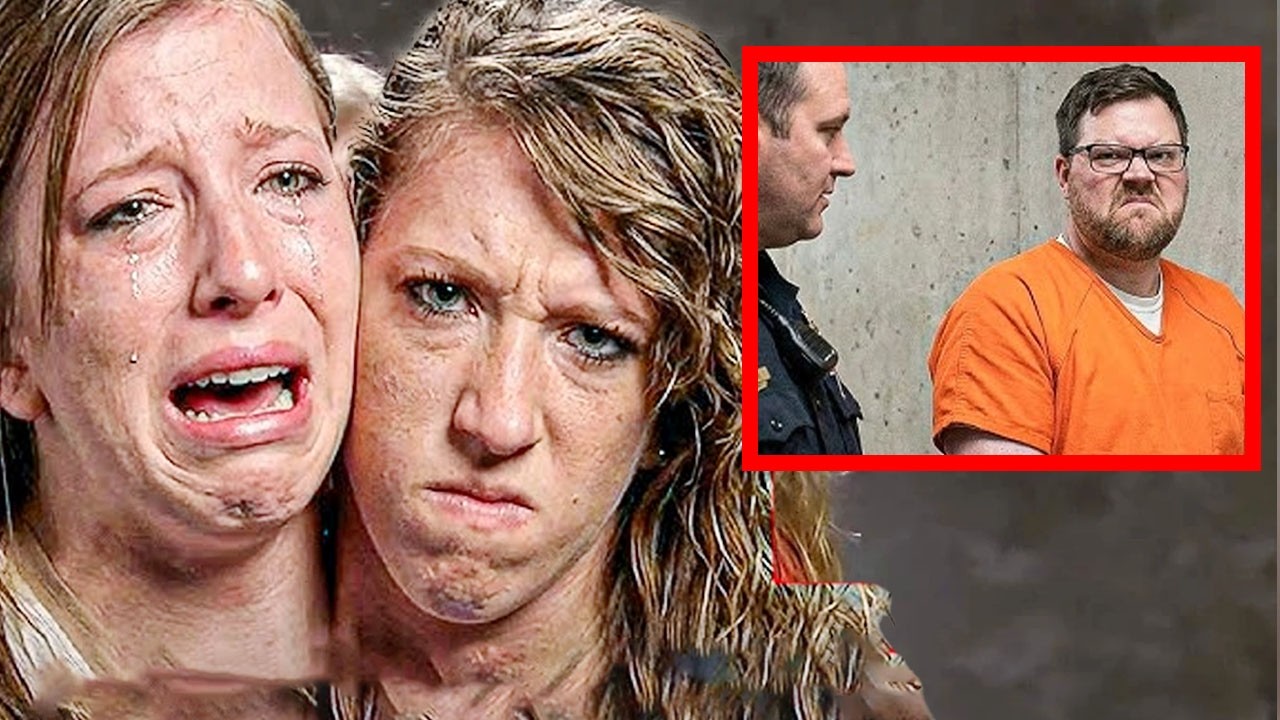 Hast du schon gehört, was mit den siamesischen Zwillingen Abby und Brittany passiert ist?