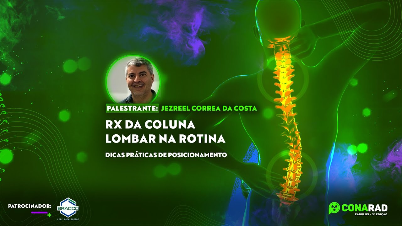 Rx da Coluna Lombar na rotina - dicas práticas de posicionamento