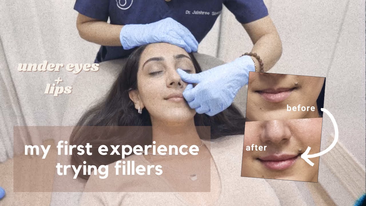 I tried fillers with India's #1 celeb dermatologist and this is how it went |  Dr. Jaishree Sharad