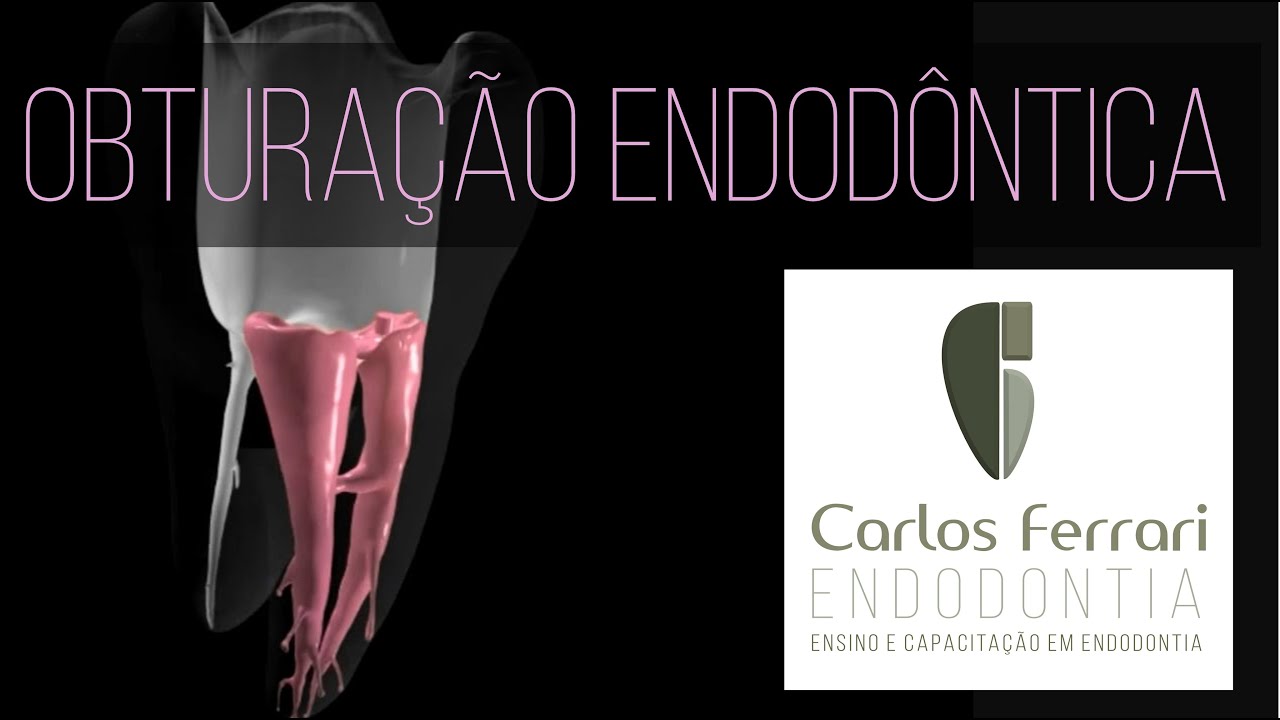 Obturação na Endodontia - Palestra completa