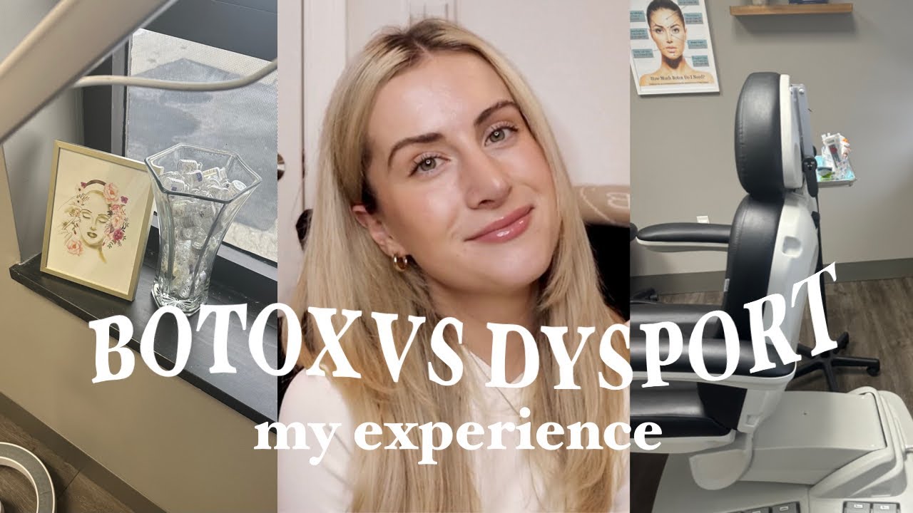 BOTOX VS DYSPORT EXPERIENCE (procedure & why I did it as a 25 year old)