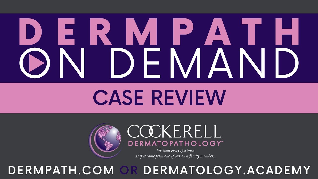 Case Review | Episode 30
