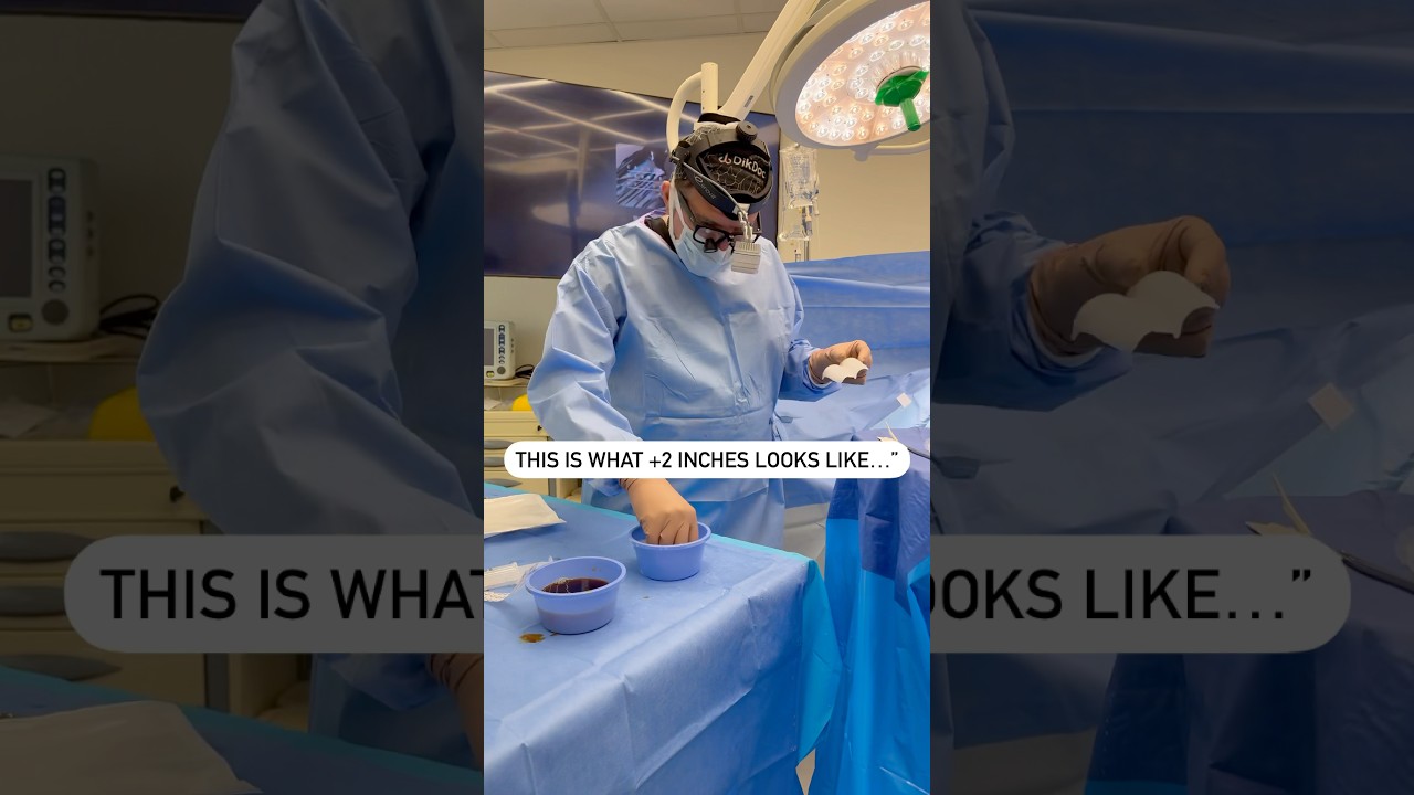 This is how we change lives&mdash;one Himplant at a time. No gimmicks. #menshealth #urology #drtajkarimi
