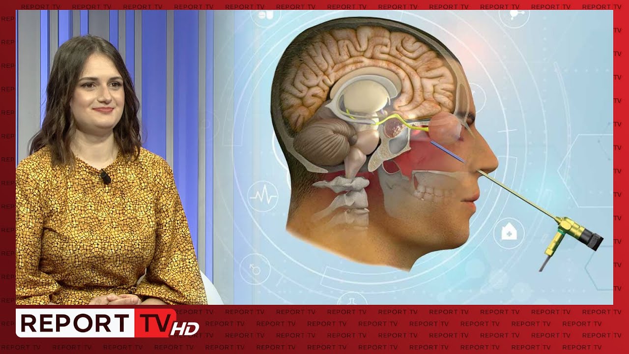 Si trajtohet një tumor i hipofizës dhe sa e rrezikshme është ndërhyrja kirurgjikale? Flet mjekja