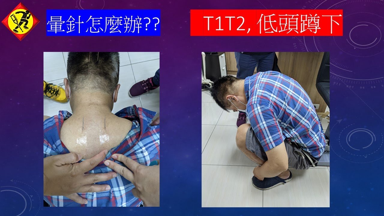 迷走神經性昏厥Vasovagal Syncope