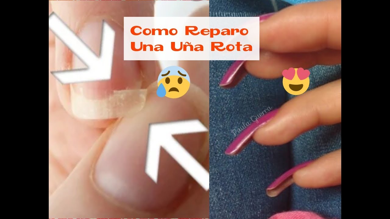 ! CÓMO REPARAR TU UÑA ROTA | DOS OPCIONES |