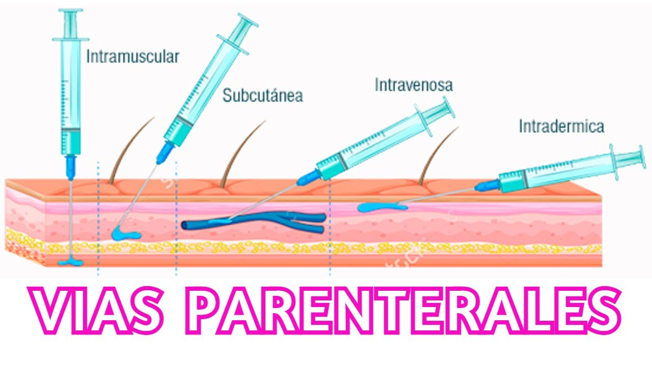 Generalidades vías parenterales/ Cofia Educativa