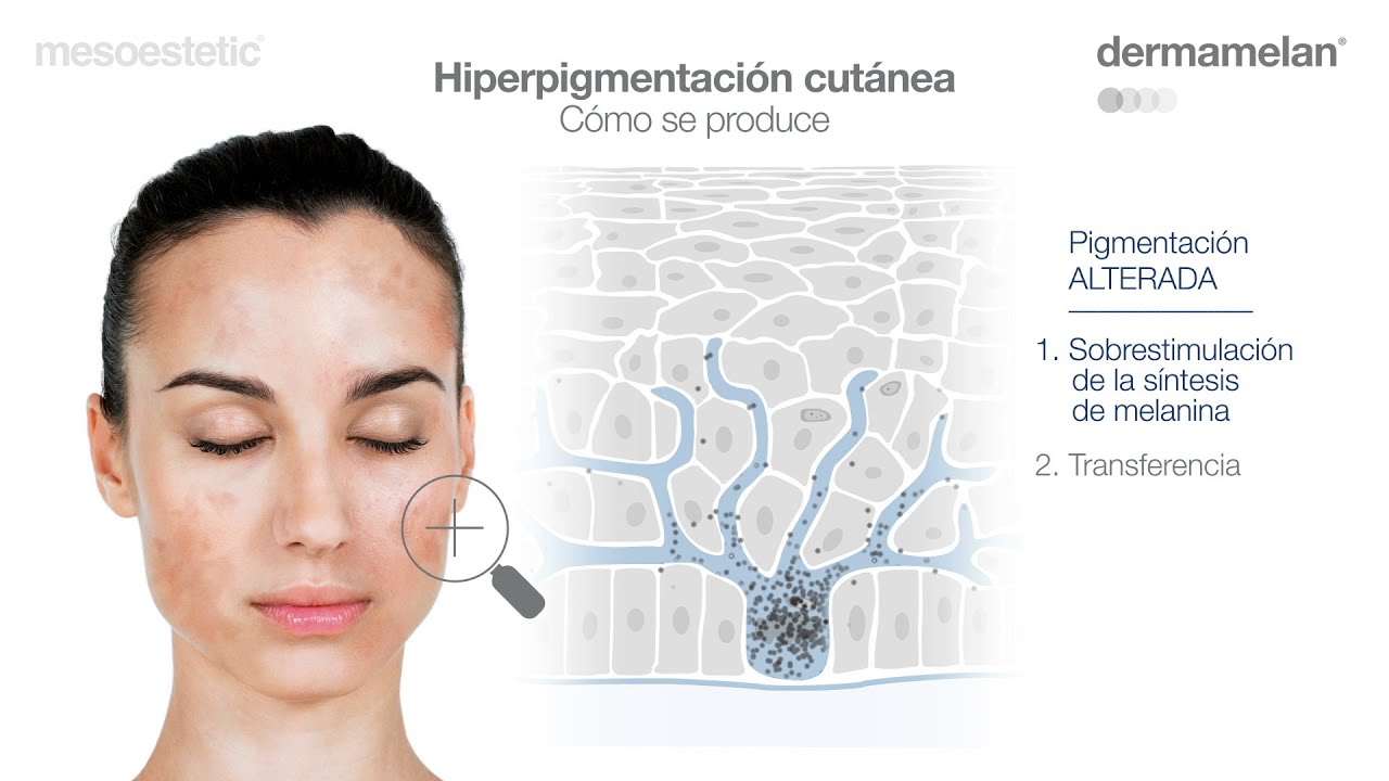 Dermamelan Guía de Uso (Español)