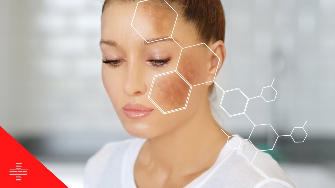10 Surprising Causes of Age Spots and How to Prevent Them