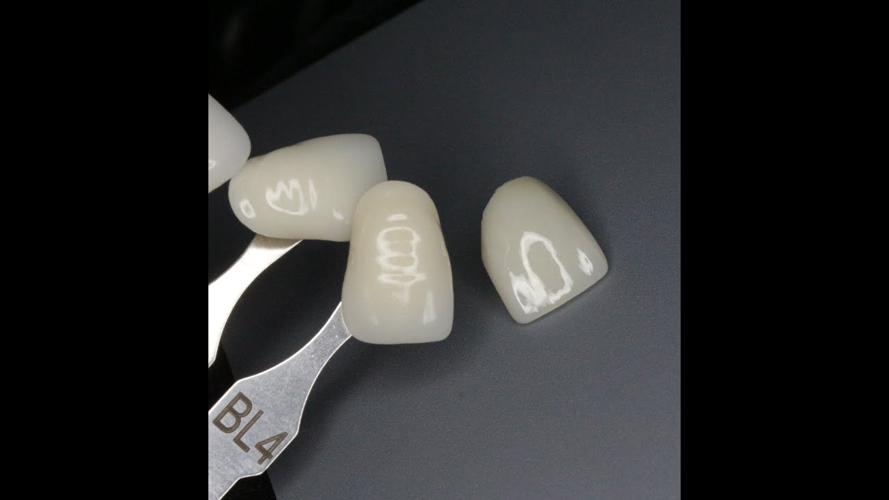 #БЛИЧ  4 В ОДИН ОБЖИГ #виниры #dentistry #ONE BAKE #стоматология #зубы #implants #stomatology #emax