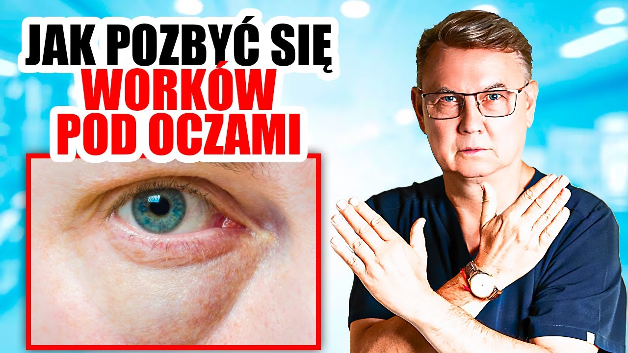 Jak Pozbyć Się WORKÓW POD OCZAMI?