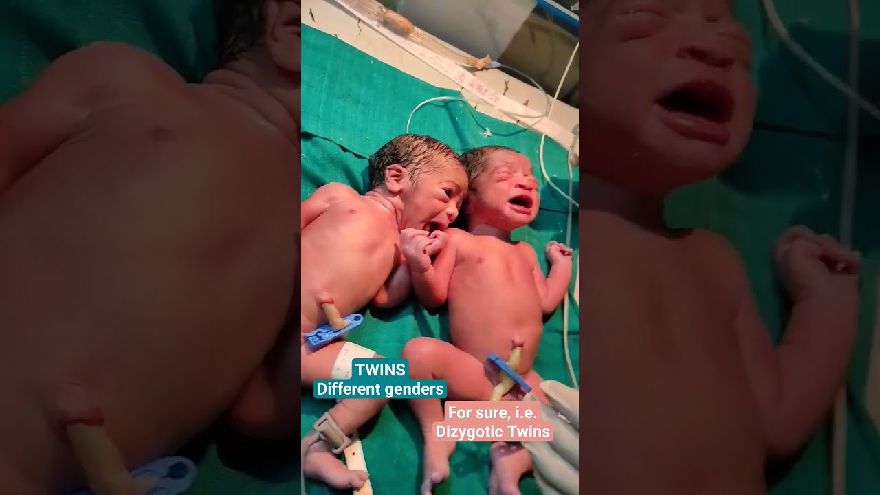 Dizygotic Twins #aiims #neetmotivation #mbbs #doctoronduty