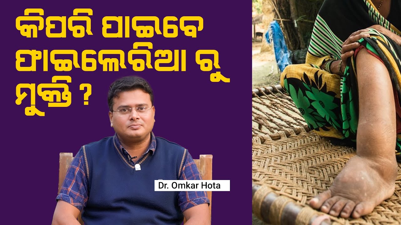 Swelling in the leg? May be Filariasis | Dr Omkar Hota |  Swasthya Sambad | Odisha