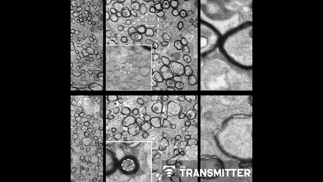 Oligodendrocytes need mechanical cues to myelinate axons correctly