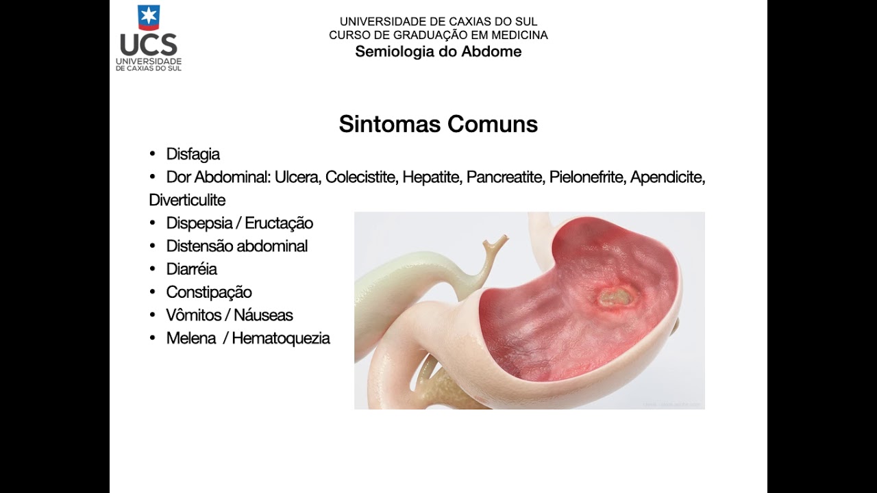 Semiologia do Abdome