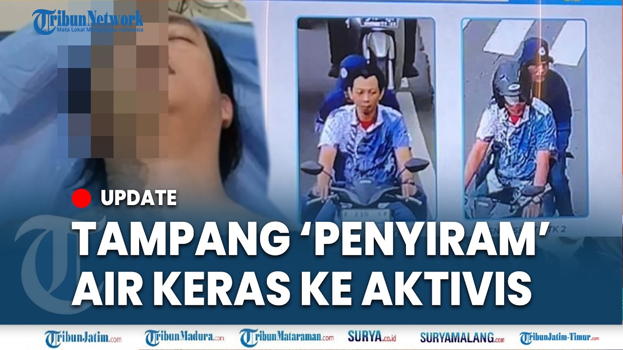 🔴ANGGOTA TNI DIDUGA TERLIBAT PENYIRAMAN AIR KERAS Terhadap Andrie Yunur, Pelaku Lebih dari Empat