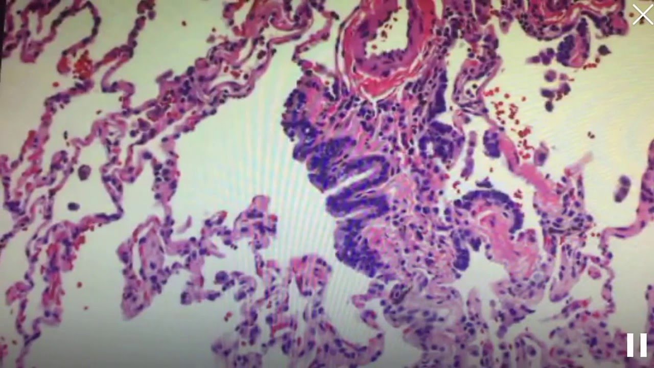Respiratory bronchiole (histology of the lung)