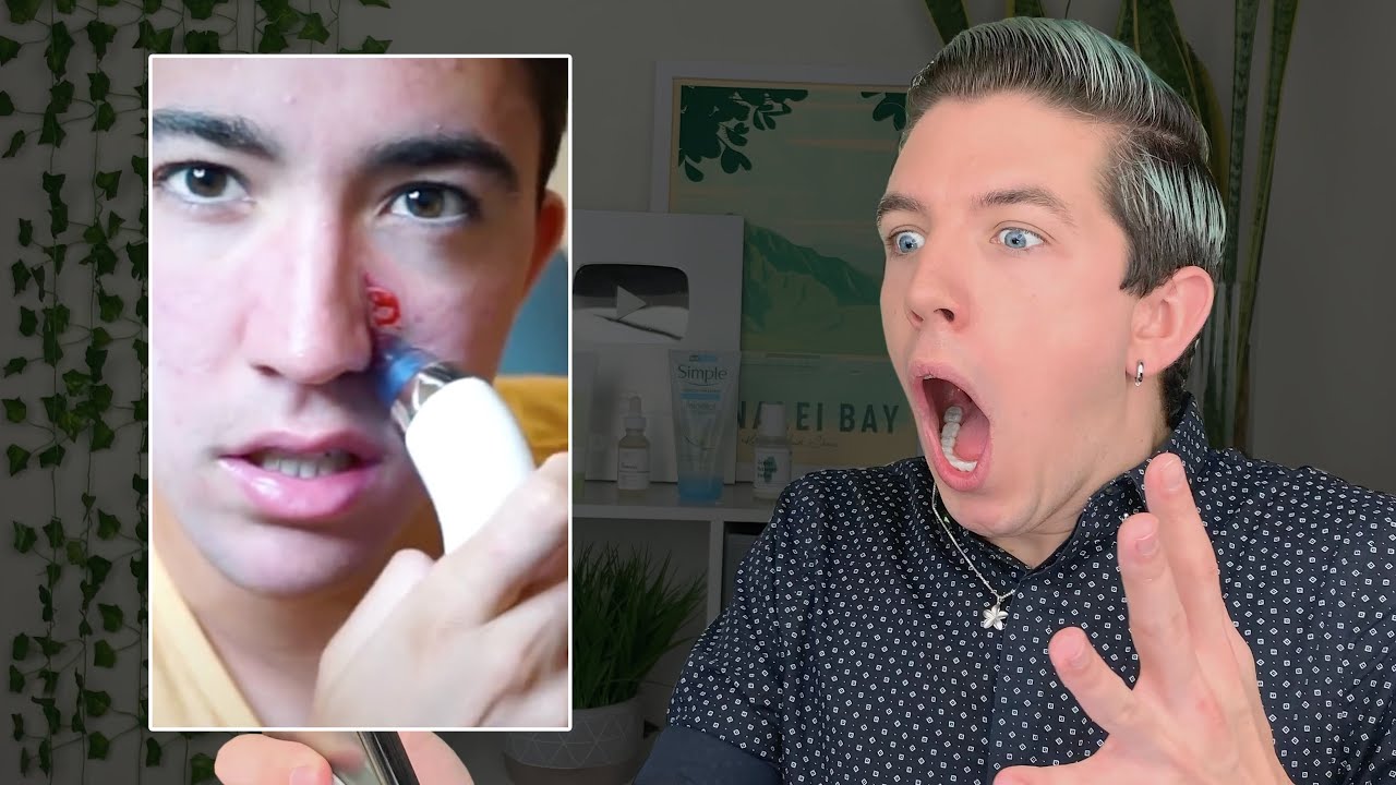 Специалисты отреагировали на «хаки» от прыщей в Tik Tok