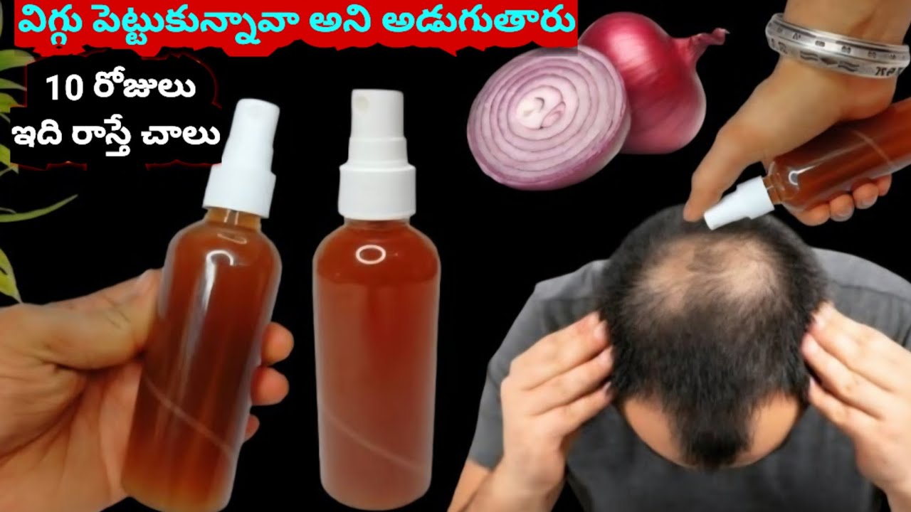 విగ్గు పెట్టుకున్నావా అని అడుగుతారు 10 రోజులు ఇది రాస్తే చాలు ఇంక ఏమీ రాయవసరం లేదు