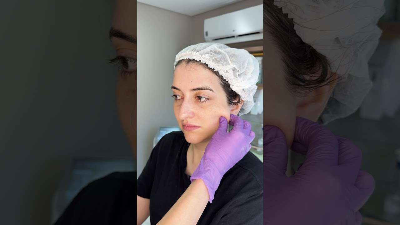 Procedimento HIPRO