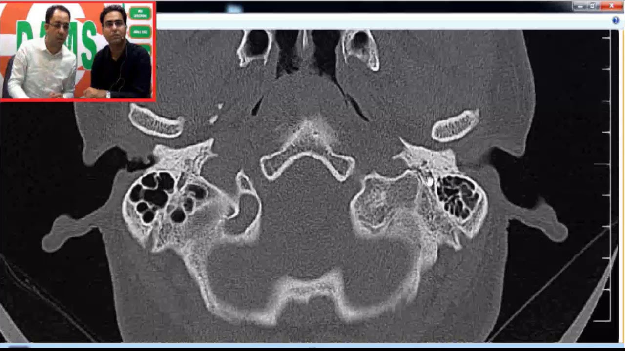 Temporal Bone CT | Radioclinical Perspective