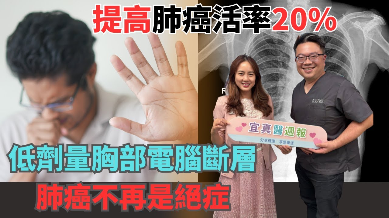 低劑量胸部電腦斷層，肺癌不再是絕症《宜真醫週報》349集