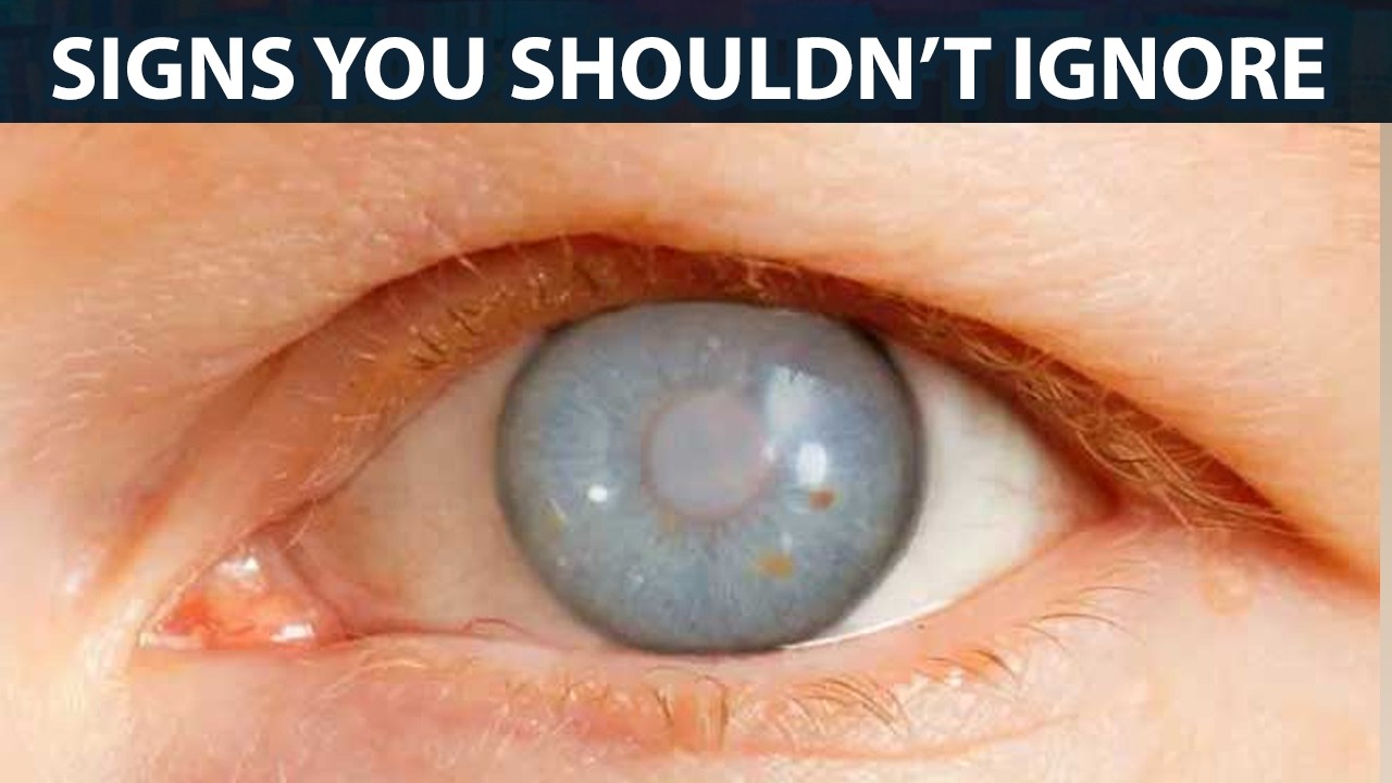 Your Eyes Are Talking: Subtle Signs You Shouldn’t Ignore