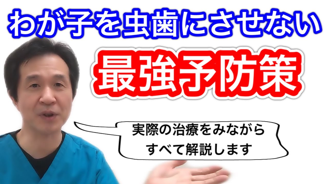 【シーラント、溝埋め】子供の奥歯は要注意！！実際の治療シーンは後半で