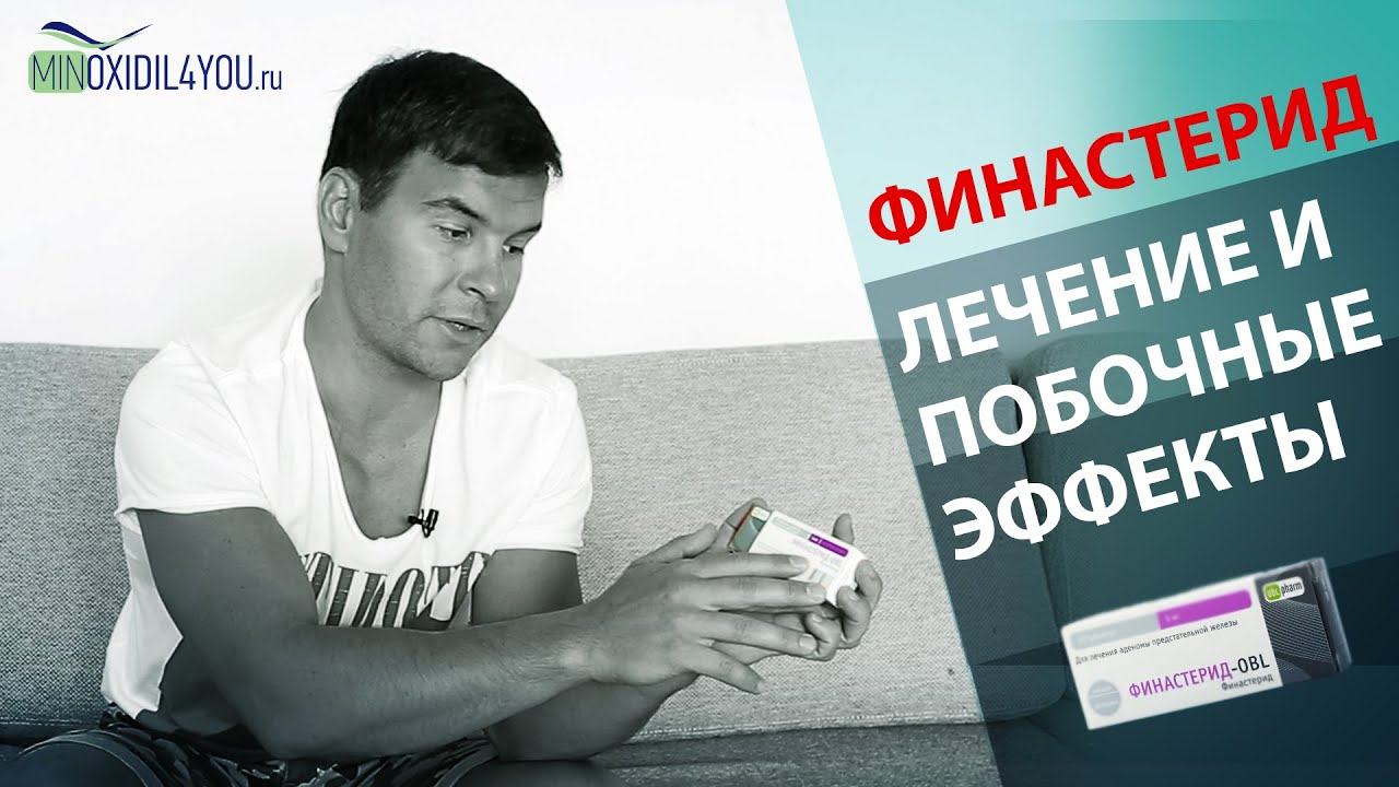 ФИНАСТЕРИД ЛЕЧЕНИЕ И ПОБОЧНЫЕ ЭФФЕКТЫ. ЕСТЬ ЛИ СНИЖЕНИЕ ЛИБИДО ОТ ФИНАСТЕРИДА. Minoxidil4you