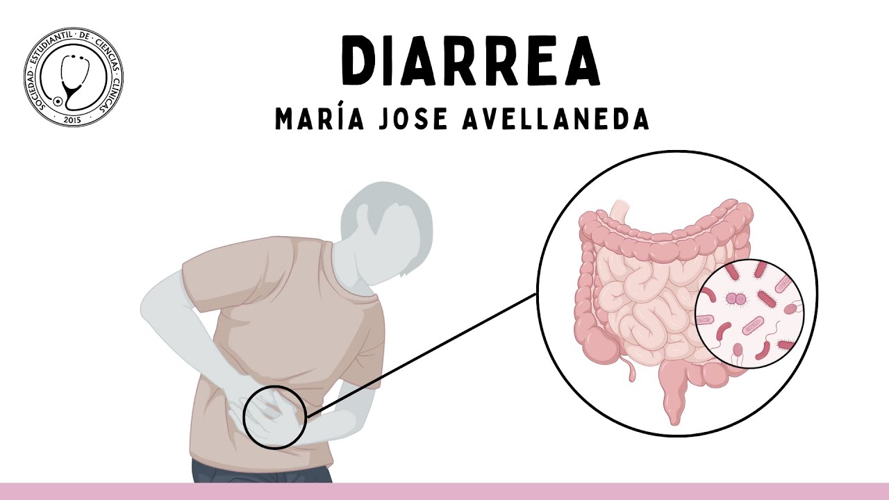 DIARREA: Fisiopatología, Clínica, Diagnóstico y Manejo | Semiología