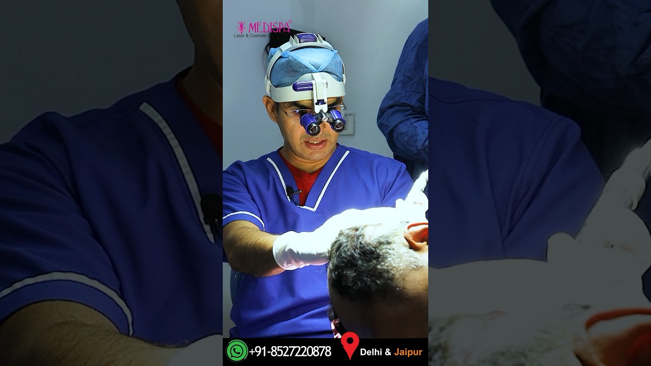 Advanced FUE Hair Transplant in India by Dr Suneet Soni #fuehairtransplant #hairtransplantinindia
