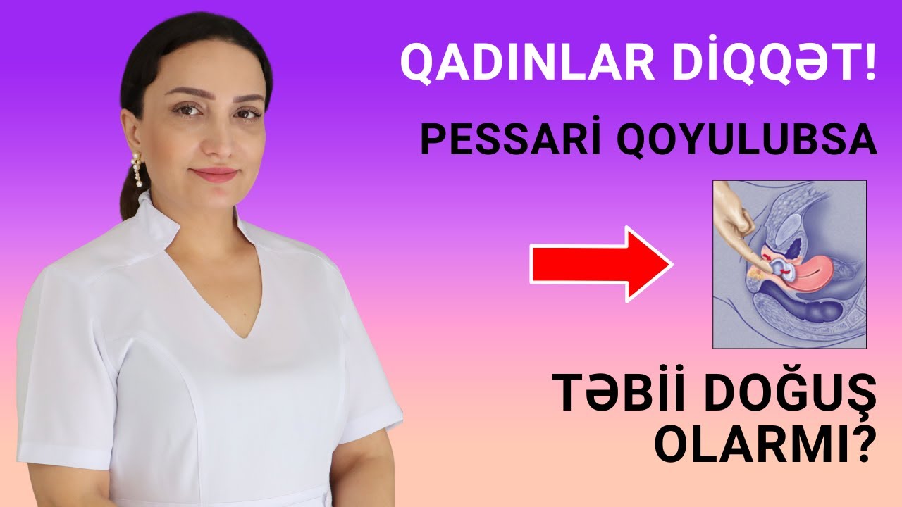 Qadınlar DİQQƏT! Pessari qoyulubsa Təbii DOĞUŞ olarmı?