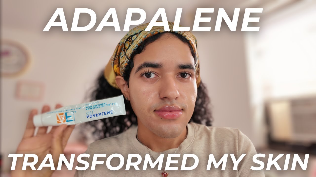Adapalene CLEARED My Acne  | Inspo from @JenniferMyers