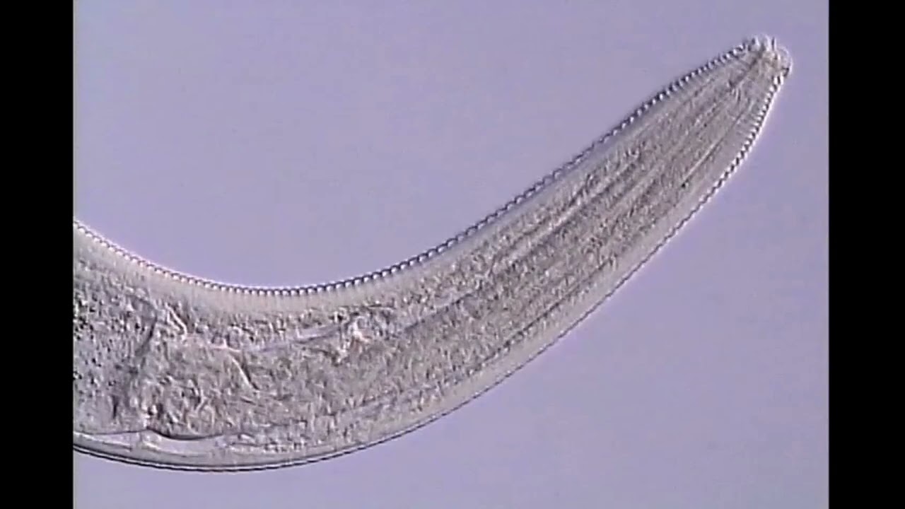 Metacrobeles female nematode neck