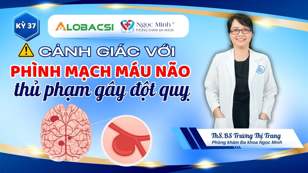 #37 Cảnh giác với phình mạch máu não thủ phạm gây đột quỵ | ThS.BS Trương Thị Trang
