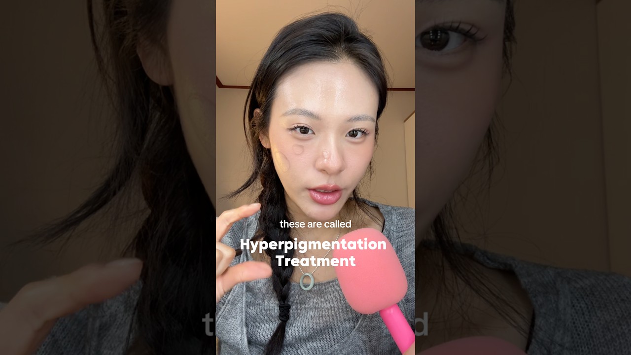 HYPERPIGMENTATION TREATMENT🥹⁉️ #koreanskincare