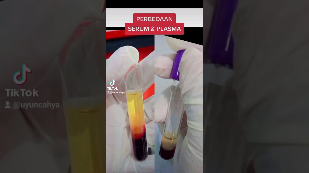 PERBEDAAN SERUM & PLASMA DARAH #kesehatan #laboratory #shorts #edukasi #darah #serum #analyst