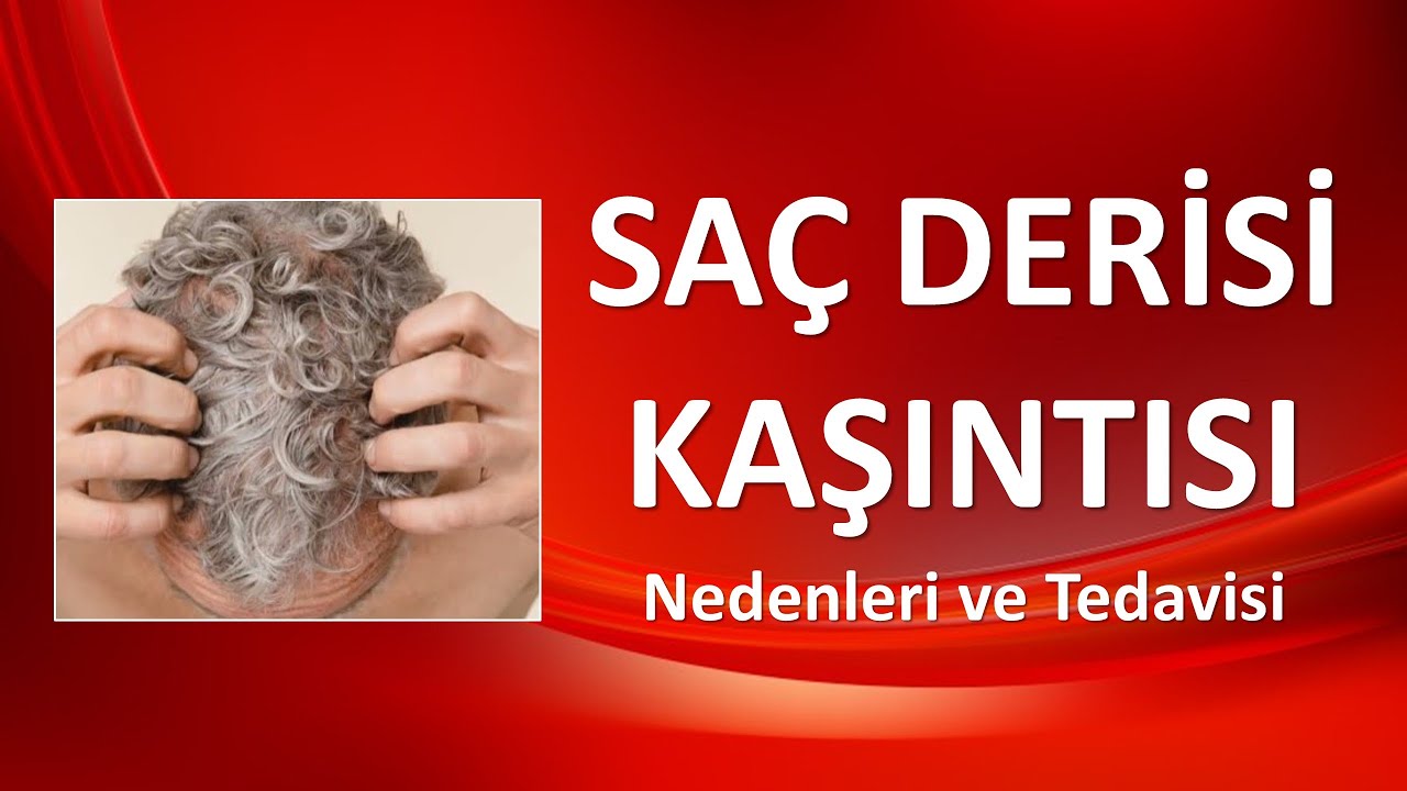 SAÇ DERİSİ KAŞINTISI Nedenleri ve Tedavisi