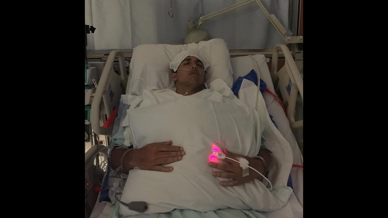 MY ACCIDENT - The Full Story | COREY SCHERER