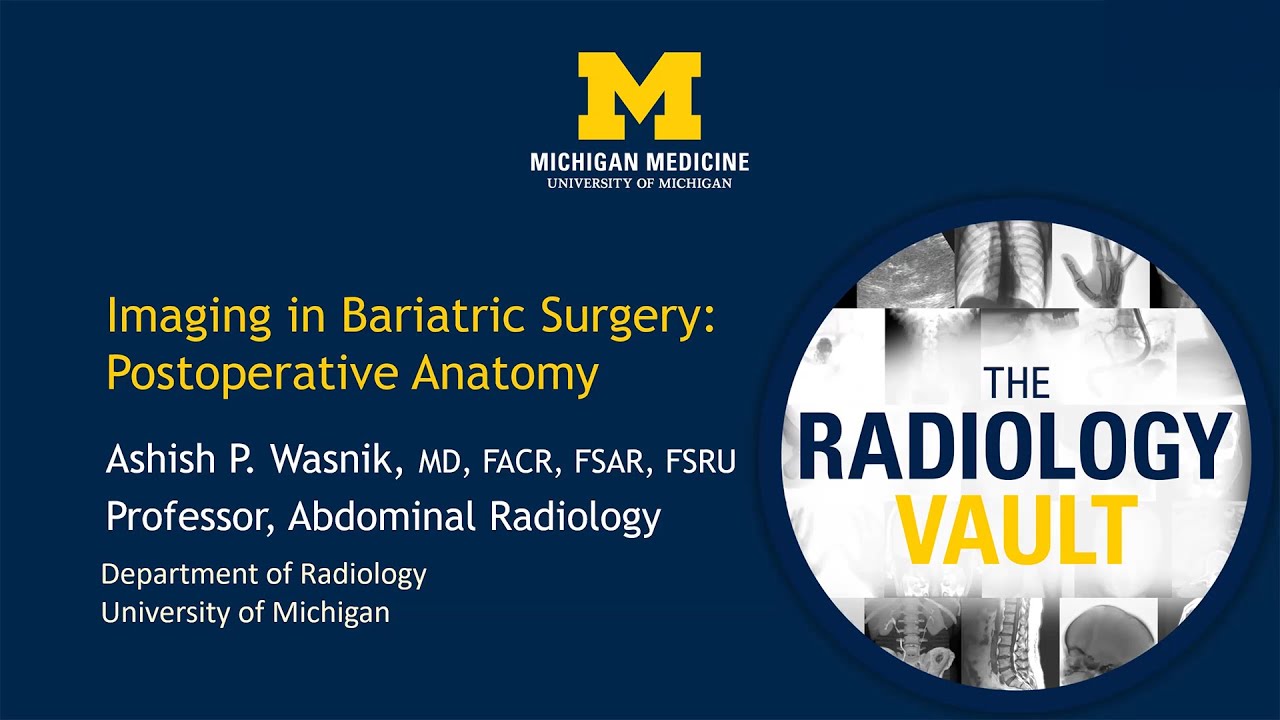 CT & X-Ray of Bariatric Surgery Anatomy