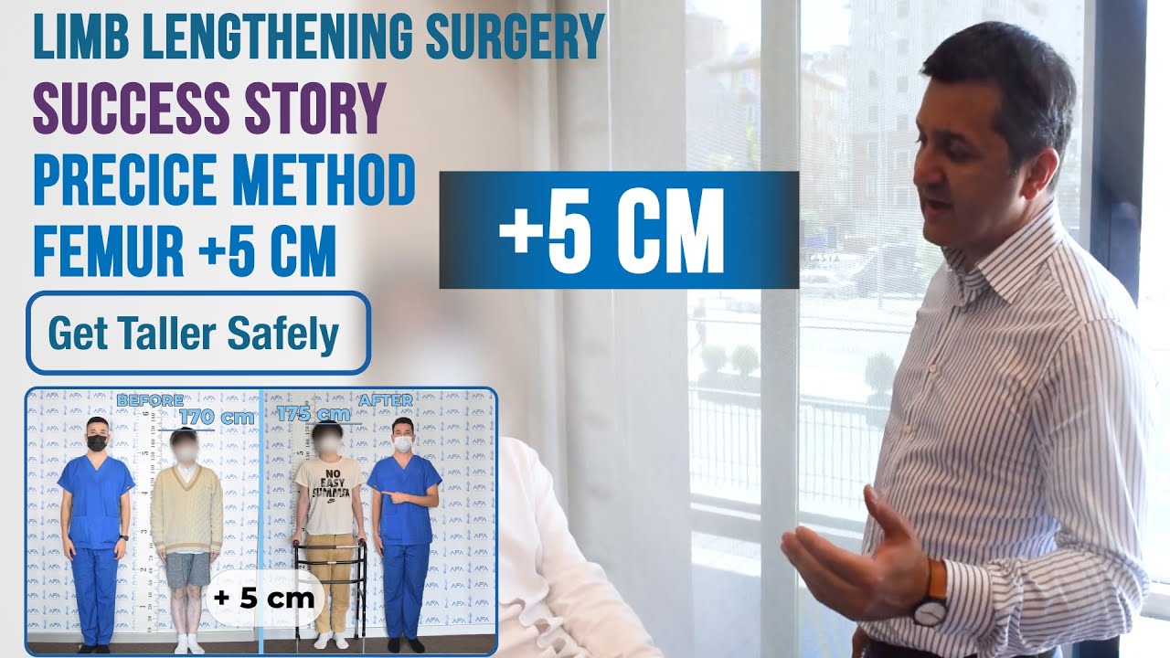 5 cm Taller on Femurs with Limb Lengthening/Precice 2