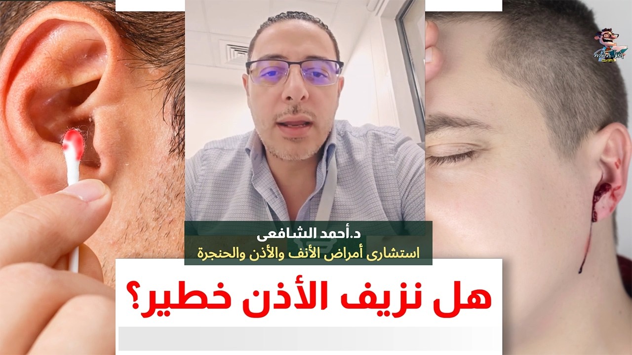 إسعافات نزيف الأذن في المنزل | اهلا يا دكتور اسباب خروج الدم من الاذن