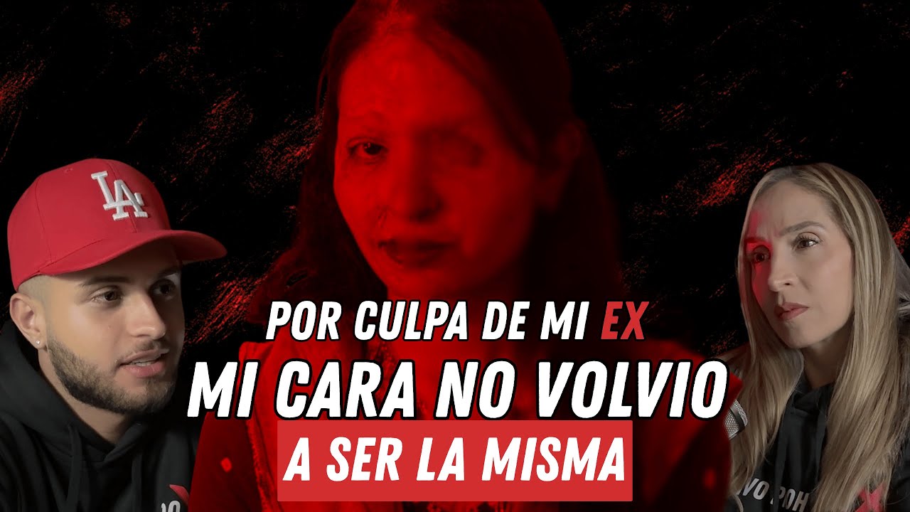 Mi ex me lanzó 4CID0 en la CARA.