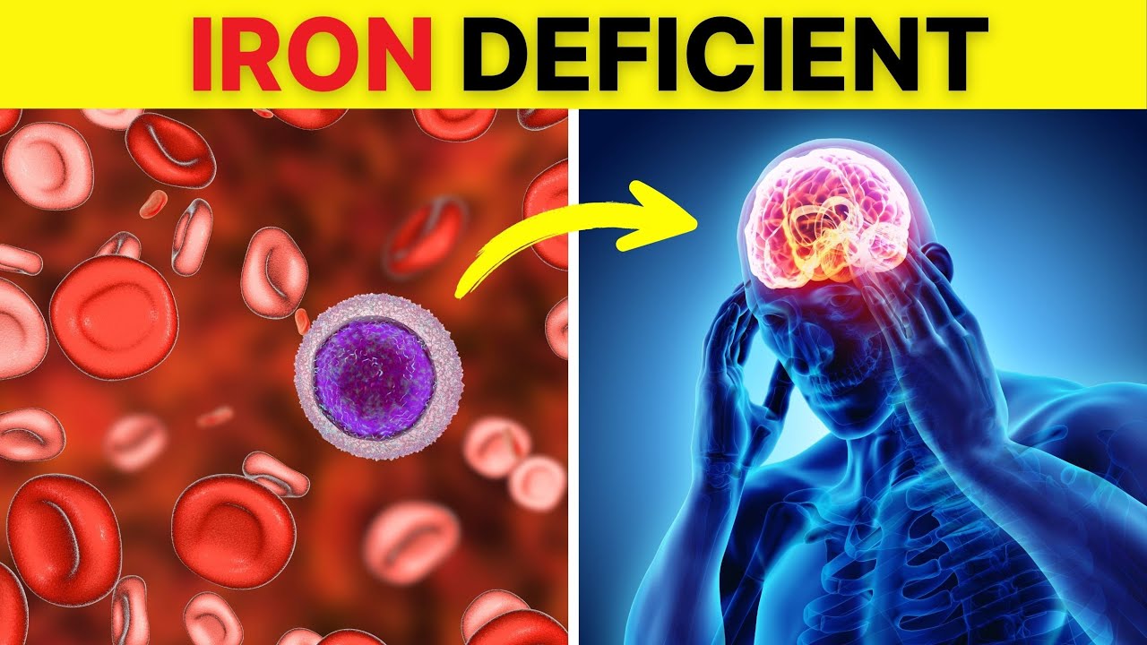7 Warning Signs of Iron Deficiency You Should Never Ignore!