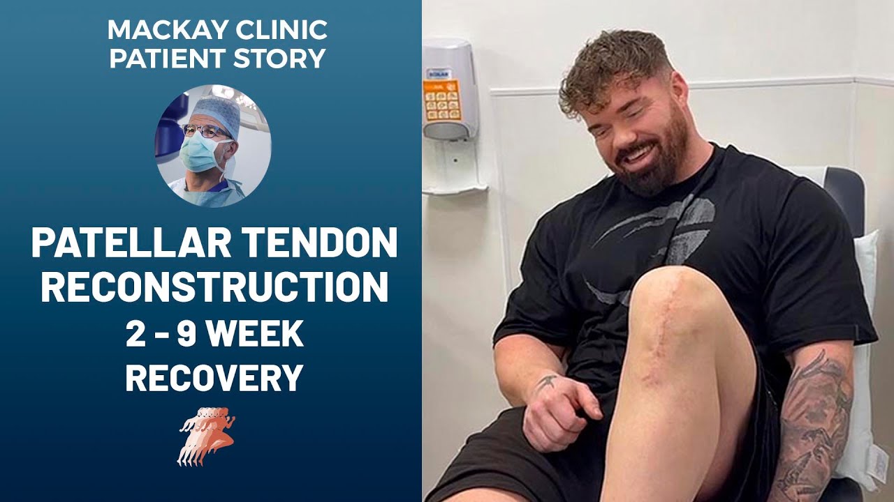 “Night and Day”: Patellar Tendon Reconstruction Recovery (2–9 Weeks)