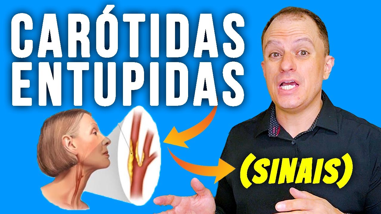 🚨 5 SINAIS de que suas ARTÉRIAS CARÓTIDAS estão ENTUPIDAS! O ÚLTIMO é o mais PERIGOSO!