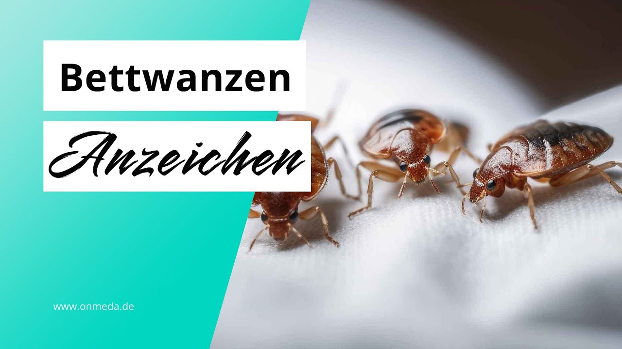 Seltsame Bisse am K&ouml;rper? So erkennst du, ob es sich um Bettwanzen handelt